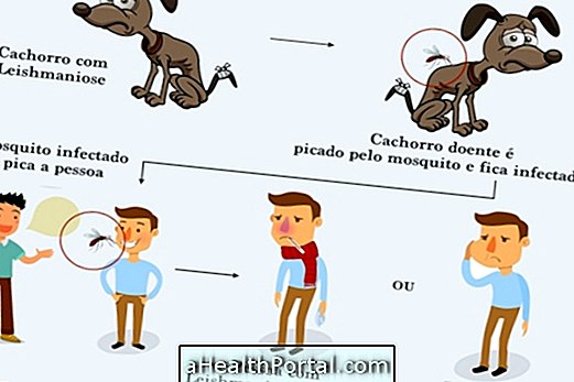 อาการที่ระบุ Leishmaniasis