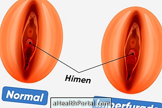 Was ist unperforiertes Hymen und wie es zu behandeln ist