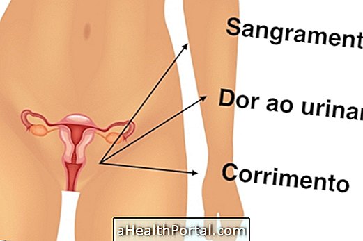 Gejala Chlamydia pada Lelaki dan Wanita