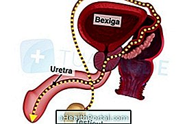 Bagaimana Untuk Memperlakukan Ejakulasi Ulang Tahun