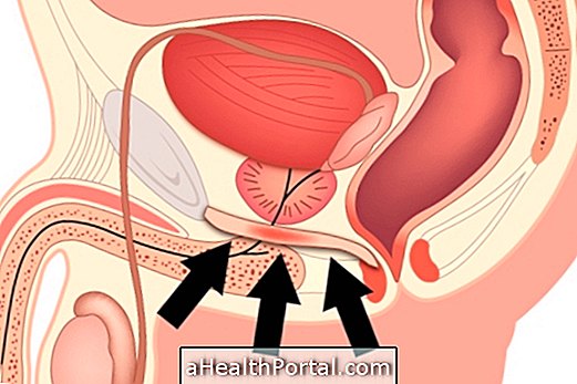 Kegel Упражнения для мужчин: преимущества, как сделать и результаты