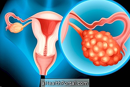 Symptom på inflammation i äggstocken