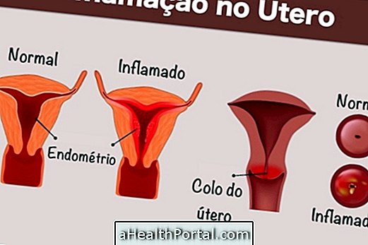 Bagaimana Mengidentifikasi dan Mengobati Peradangan di Uterus