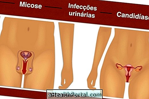 Diabetes meningkatkan risiko infeksi genital pada pria dan wanita